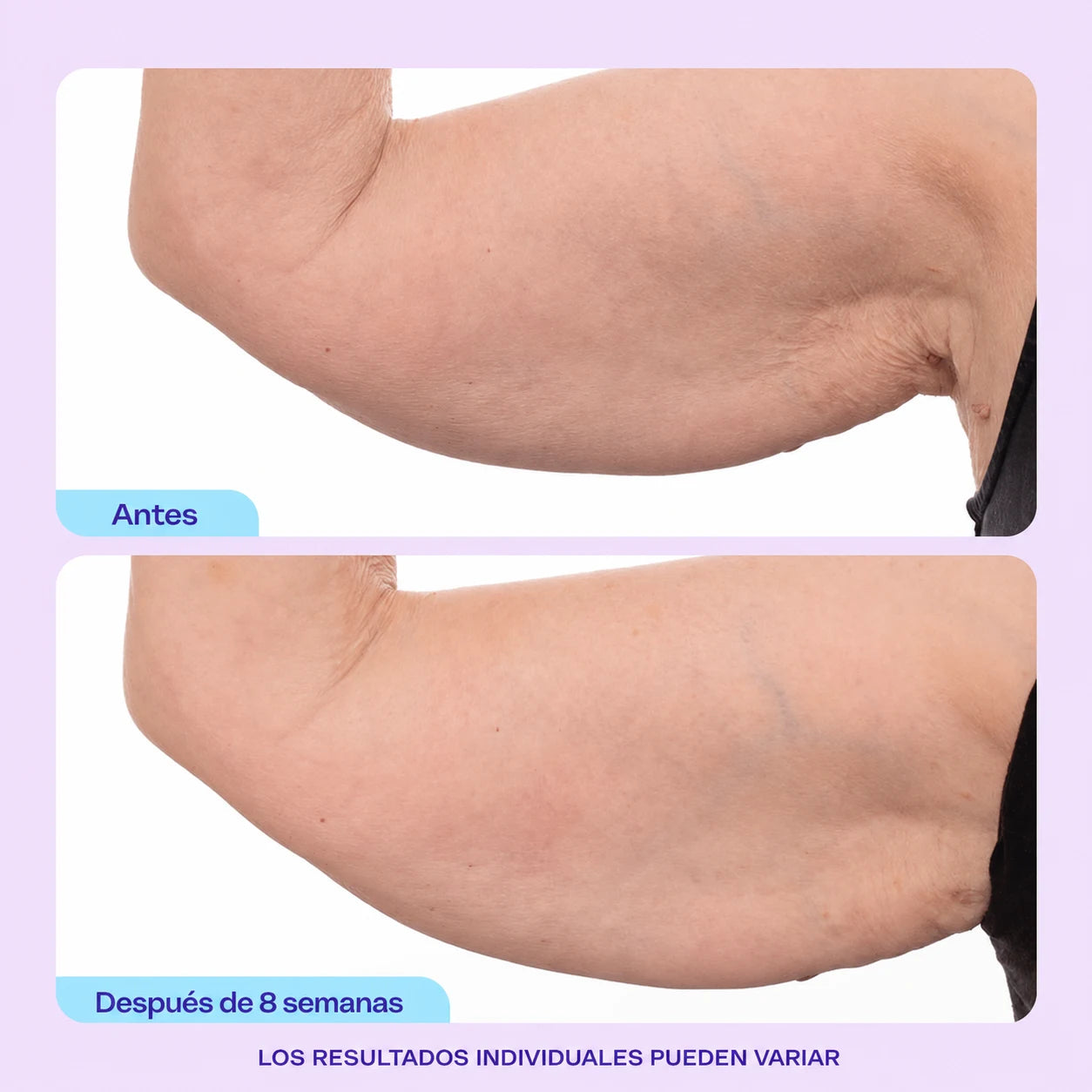 NAREVIA Crema Reafirmante para Brazos Sculpt & Tone con 7% de Complejo Reafirmante ProTight y Extracto de Raíz de Ashwagandha, 3.4 fl oz (100 ml)